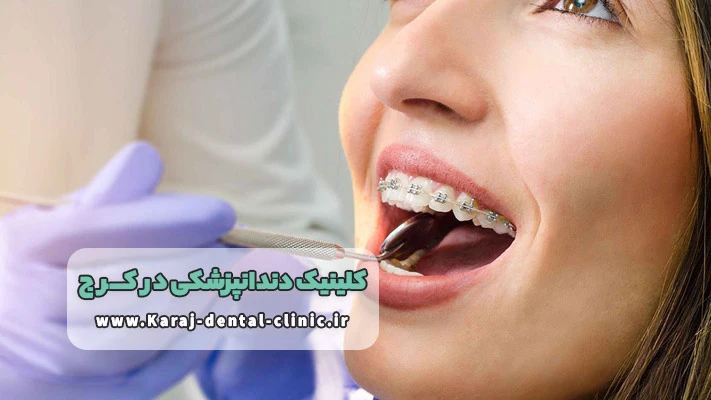 ارتودنسی راهی برای زیبایی دندان ها در دندانپزشکی کرج